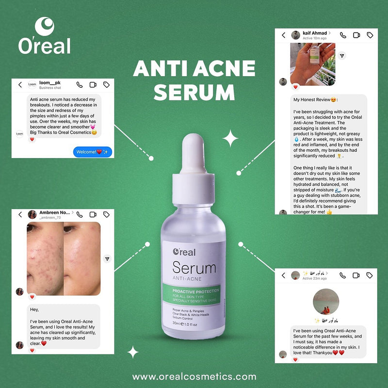 The Anti Acne Serum for Acne Control 30ML