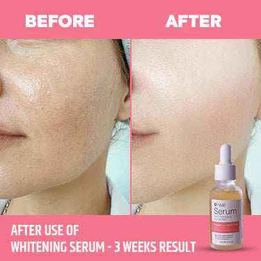 The Whitening Serum for Instant Glow 30ML - Glow Mahal